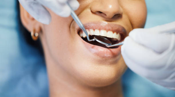 Best Emergency Tooth Extraction in Winchester, VA